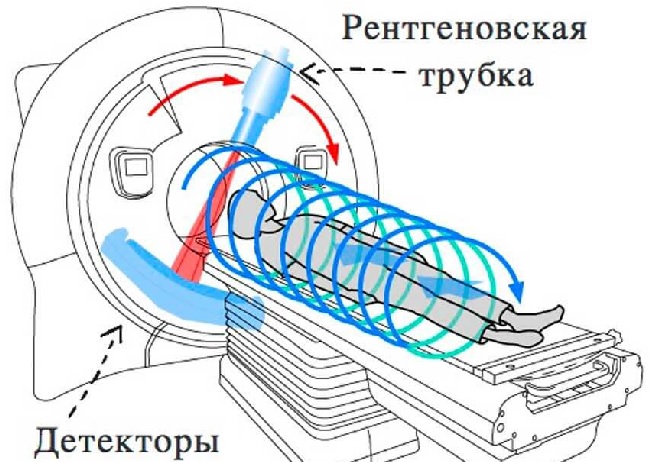 При многослойной спиральной компьютерной томографии